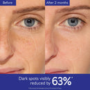 Caudalie - Skincare - Vinoperfect Brightening Dark Spot Serum Vitamin C Alternative