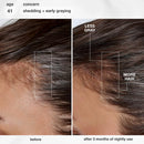 K18 Biomimetic Hairscience - Skincare - FutureIQ™ Hair Longevity Serum for Graying, Thinning, & Scalp Aging