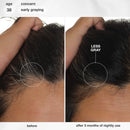 K18 Biomimetic Hairscience - Skincare - FutureIQ™ Hair Longevity Serum for Graying, Thinning, & Scalp Aging