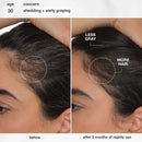 K18 Biomimetic Hairscience - Skincare - FutureIQ™ Hair Longevity Serum for Graying, Thinning, & Scalp Aging