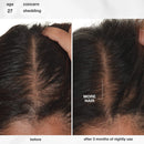 K18 Biomimetic Hairscience - Skincare - FutureIQ™ Hair Longevity Serum for Graying, Thinning, & Scalp Aging