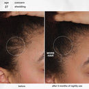 K18 Biomimetic Hairscience - Skincare - FutureIQ™ Hair Longevity Serum for Graying, Thinning, & Scalp Aging