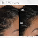 K18 Biomimetic Hairscience - Skincare - FutureIQ™ Hair Longevity Serum for Graying, Thinning, & Scalp Aging